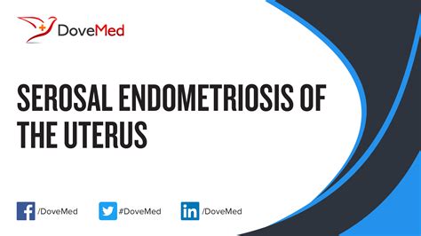 uterus in tagalog|Endometriosis .